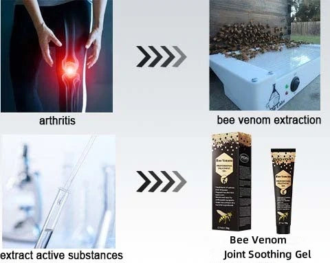 🐝New Zealand Bee Venom Joint Relief Gel(New Zealand Bee Extract - Specializes in the treatment of orthopedic conditions and arthritic pain)